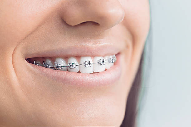Best Invisalign and Clear Aligners  in Presque Isle, ME